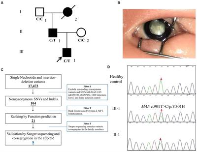 Case report: Whole exome sequencing identified a novel mutation (p.Y301H) of MAF in a Chinese family with congenital cataracts